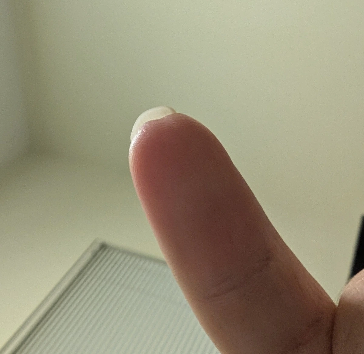 What are some small inconstancies in your body that makes you unique?